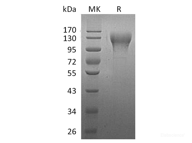 Recombinant Human CD96 / T-cell Surface Protein Tactile Protein (C-His)-Elabscience