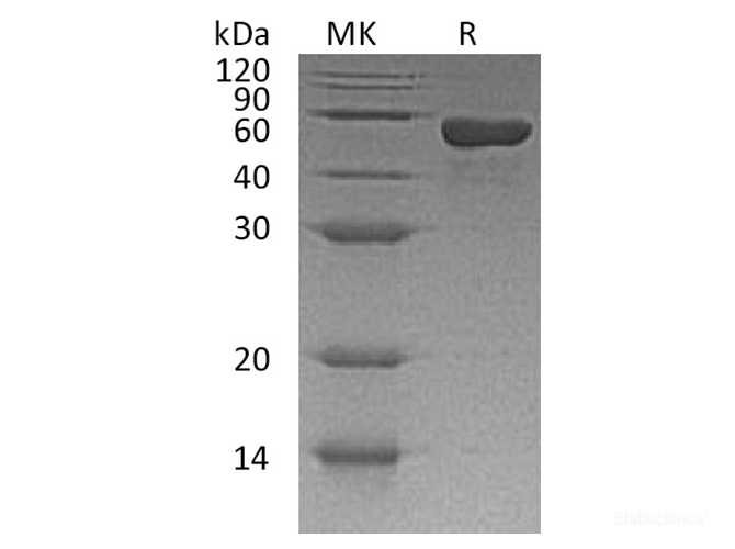 Recombinant Human CD4 / LEU3 Protein (C-His)-Elabscience