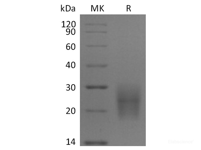 Recombinant Human CD3d / CD3 delta Protein (C-His)-Elabscience