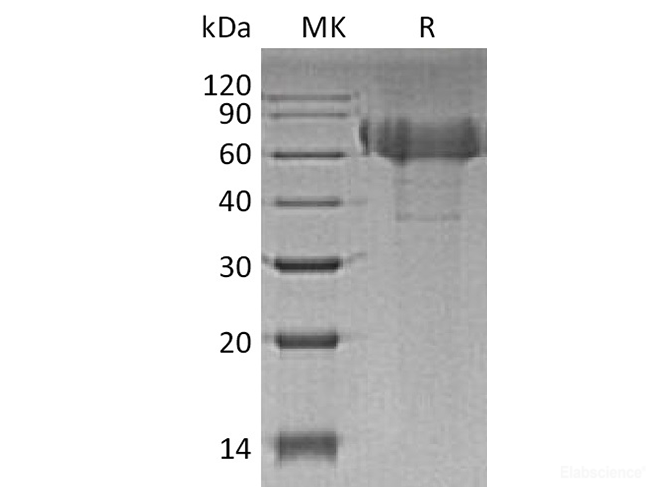 Recombinant Human TIM4 / TIMD4 Protein (C-His)-Elabscience