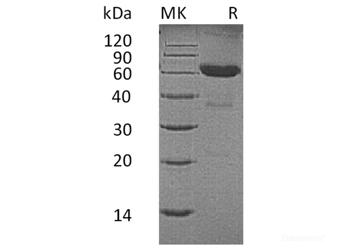 Recombinant Human CD7 / GP40 / TP41 Protein (C-Fc)-Elabscience