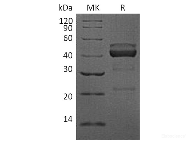 Recombinant Human TIGIT / VSIG9 / VSTM3 Protein (C-mFc)-Elabscience
