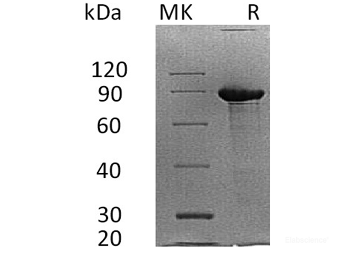 Recombinant Human Syndecan-1 / SDC1 / CD138 Protein (C-Fc)-Elabscience