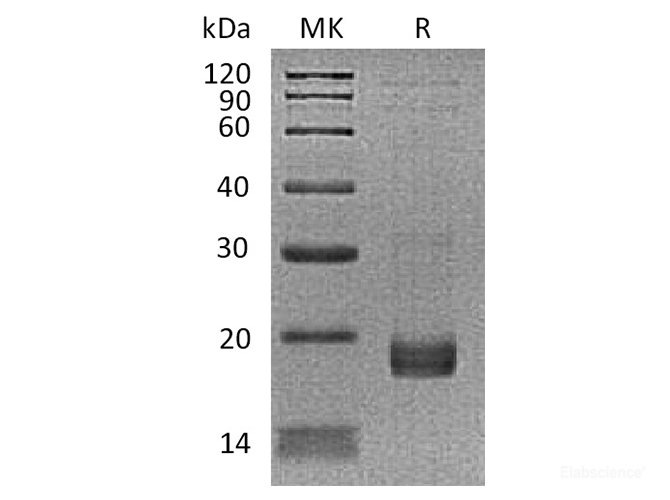 Recombinant Human Troponin C / TNNC1 Protein (N-His)-Elabscience
