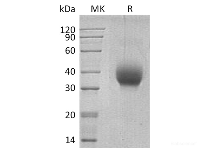 Recombinant Human SLAMF6 / CD352 Protein (C-His)-Elabscience
