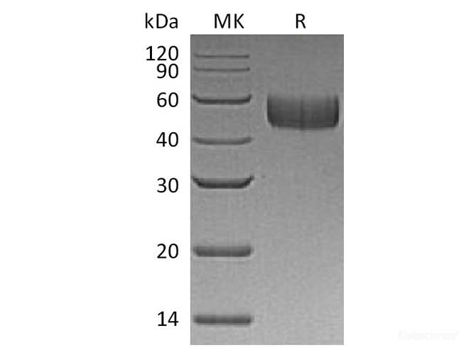 Recombinant Human SIRPB1 / CD172b Protein (C-His)-Elabscience