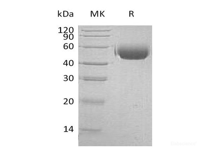 Recombinant Human CD172a / SIRPA Protein (C-His)-Elabscience