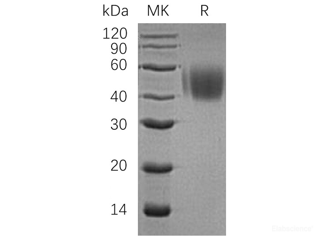 Recombinant Human CD150 / SLAM Protein (C-His)-Elabscience