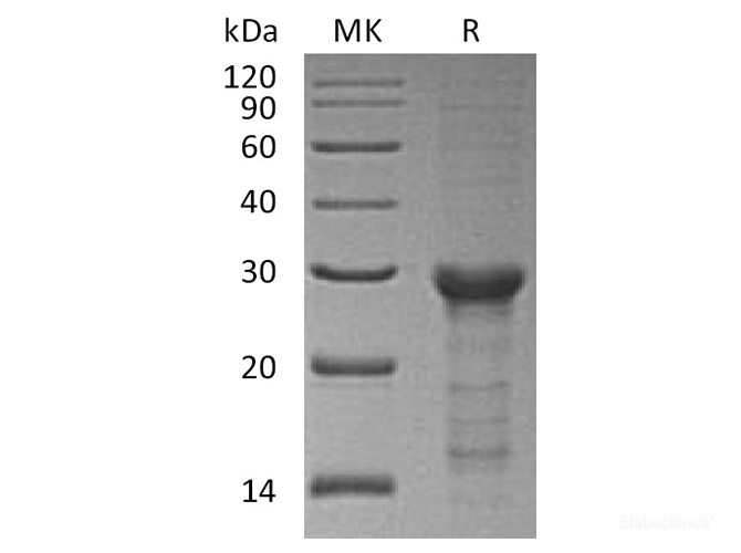 Recombinant Human STAT6 Protein (C-His)-Elabscience