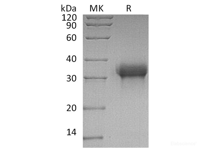 Recombinant Human SIGLEC15 / CD33L3 Protein (C-His)-Elabscience