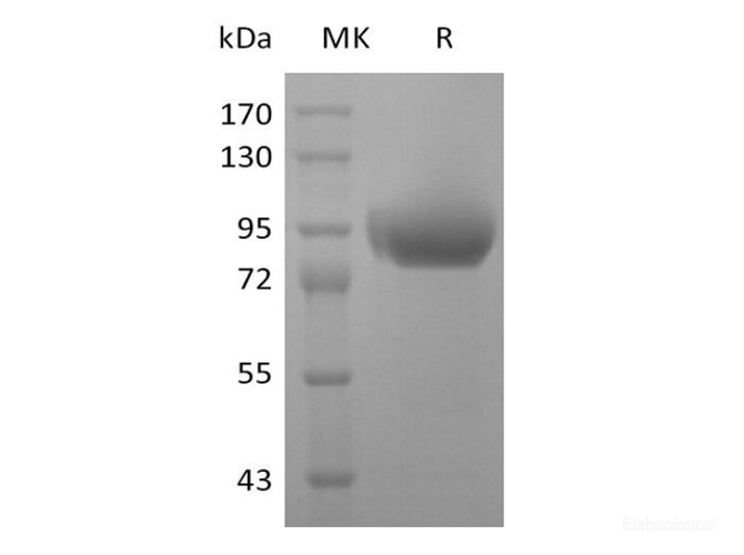 Recombinant Human SIGLEC5 / CD170 Protein (C-His-Flag-Fc)-Elabscience