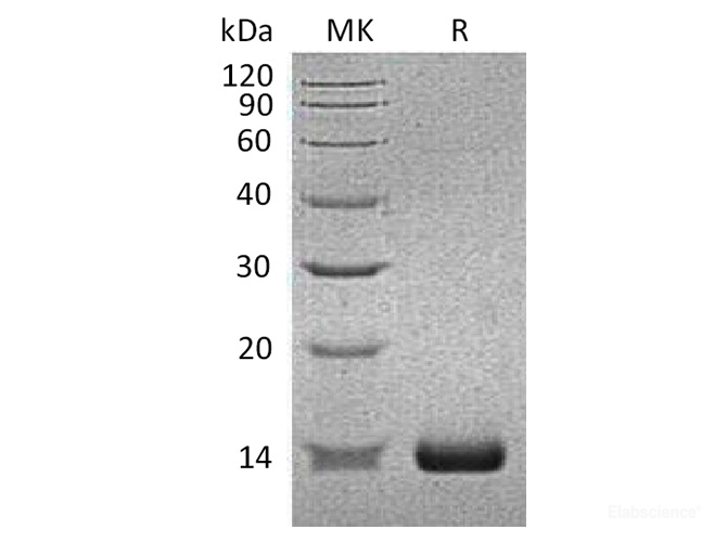 Recombinant Human SAA2 / Serum Amyloid A2 Protein (N-His)-Elabscience