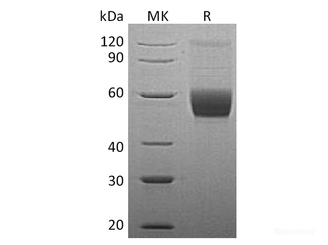 Recombinant Human Vaspin / Serpin A12 Protein (C-His)-Elabscience