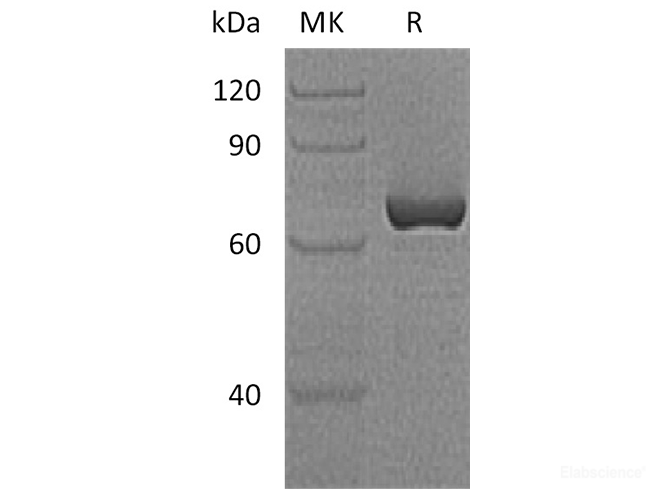 Recombinant Human Vaspin / Serpin A12 Protein (N-GST)-Elabscience