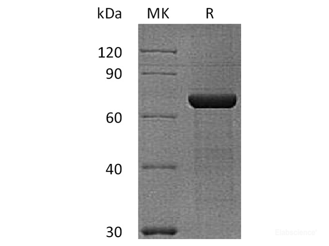 Recombinant Human Semaphorin-3A / SEMA3A Protein (N-His-Flag)-Elabscience