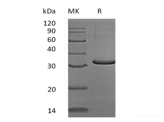 Recombinant Human SCGN / Secretagogin Protein (C-His)-Elabscience