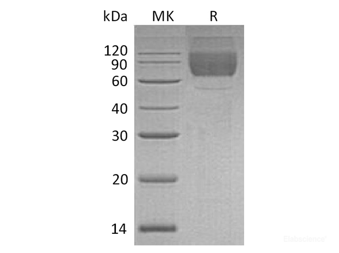 Recombinant Human LIMP-2 / SCARB2 / CD36L2 Protein (C-His)-Elabscience