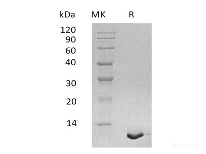 Recombinant Human S100A12 / CAGC / Calgranulin-C Protein-Elabscience