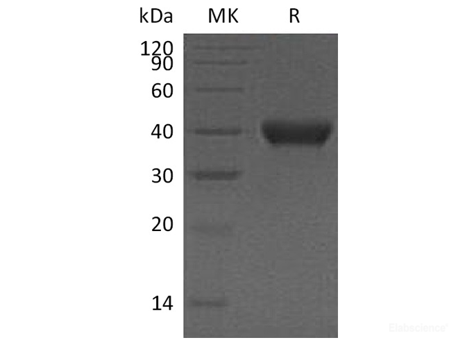 Recombinant Human RNASET2 / Ribonuclease T2 Protein (C-His)-Elabscience
