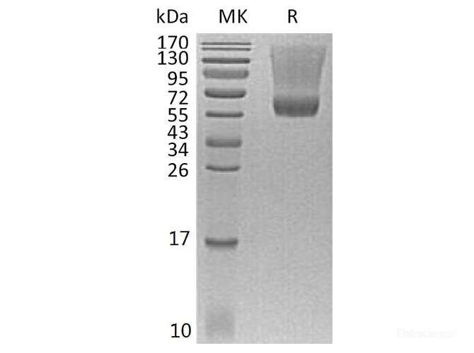 Recombinant Human Renin Protein (C-His)-Elabscience