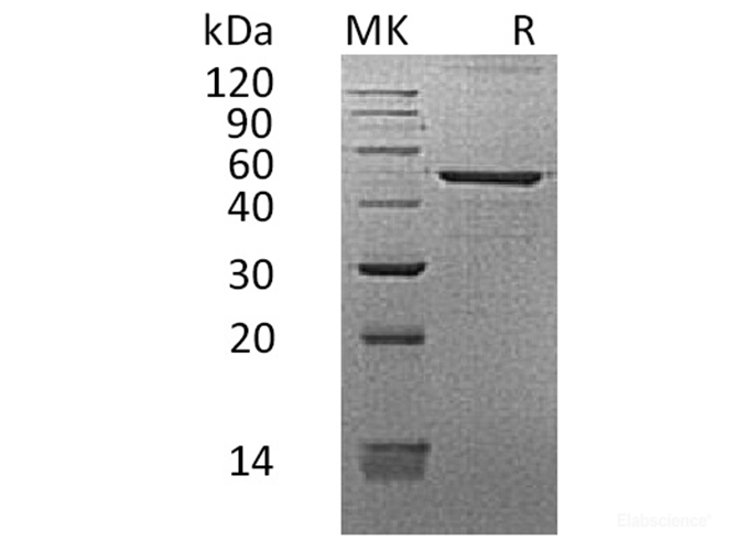Recombinant Human REG3G / PAP-1B Protein (C-Fc)-Elabscience