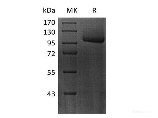 Recombinant Human FLT-3 / CD135 / FLK-2 Protein (C-Fc)-Elabscience