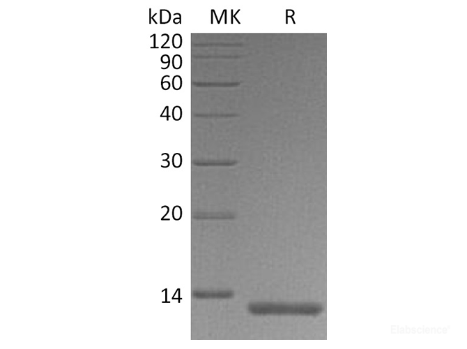 Recombinant Human S100A4 Protein (C-His)-Elabscience