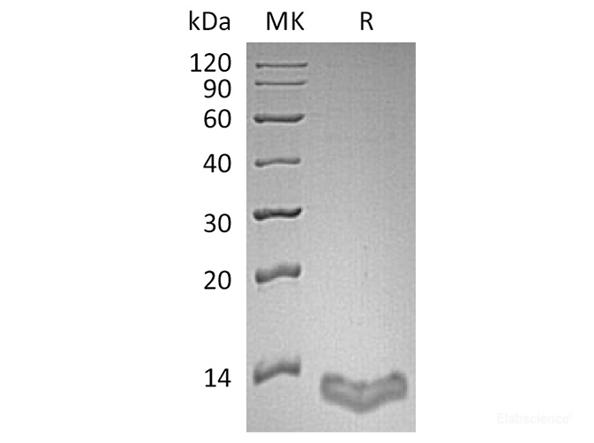 Recombinant Human S100A16 / S100F Protein-Elabscience