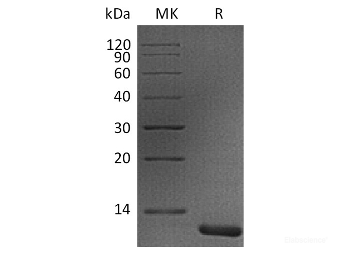 Recombinant Human S100A11 Protein-Elabscience
