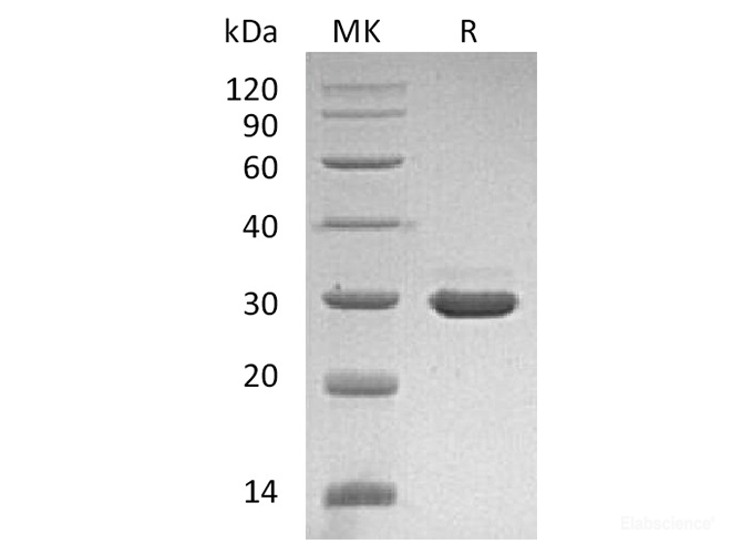 Recombinant Human β-Nerve Growth Factor / β-NGF Protein (with pro peptide) -Elabscience