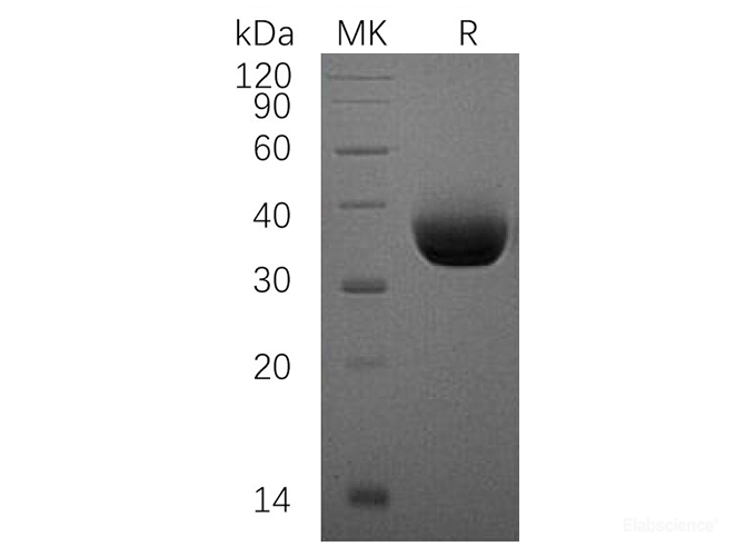 Recombinant Human PD-L1 / B7-H1 / CD274 Protein (C-His)-Elabscience