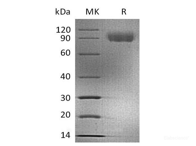 Recombinant Human CD155 / PVR / NECL5 Protein (C-mFc)-Elabscience