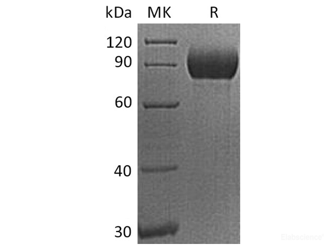Recombinant Human CD155 / PVR / NECL5 Protein (C-Fc)-Elabscience