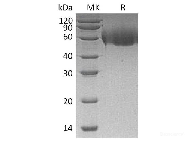 Recombinant Human CD155 / PVR / NECL5 Protein (C-His)-Elabscience