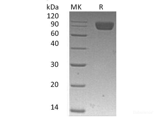 Recombinant Human PDGFRa / CD140a Protein (C-His)-Elabscience