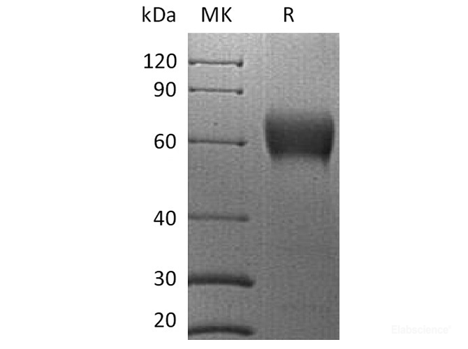 Recombinant Human VISTA / B7-H5 / PD-1H Protein (C-mFc)-Elabscience