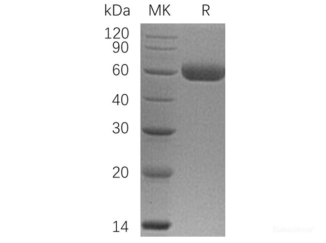 Recombinant Human Osteoprotegerin / TNFRSF11B Protein (C-His)-Elabscience