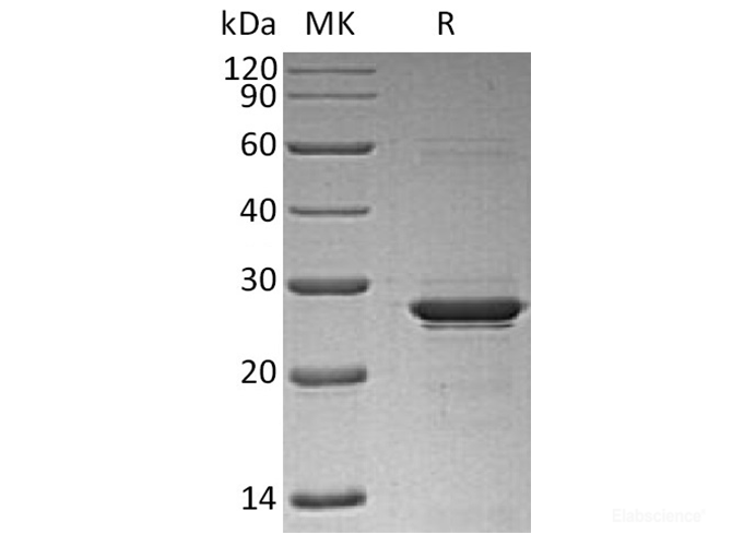 Recombinant Human Oncostatin M / OSM Protein (N-His)-Elabscience