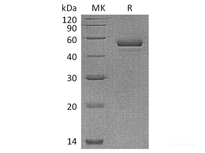 Recombinant Human NPTX1 Protein (C-His)-Elabscience