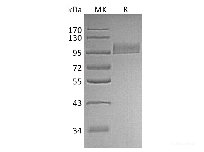 Recombinant Human Neprilysin / CD10 Protein (N-His)-Elabscience