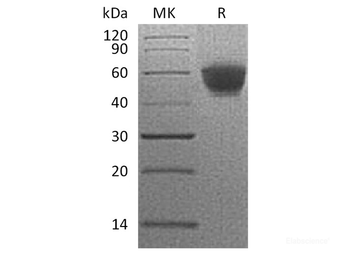 Recombinant Human NKG2D / CD314 / KLRK1 Protein (N-Fc)-Elabscience