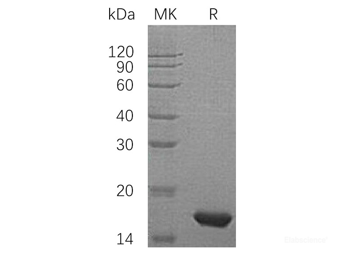Recombinant Human PMP2 / FABP8 Protein (N-His)-Elabscience