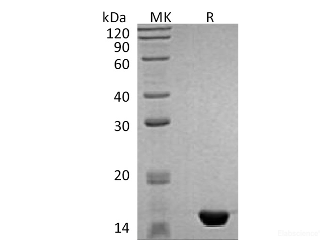 Recombinant Human MAP1LC3B Protein-Elabscience