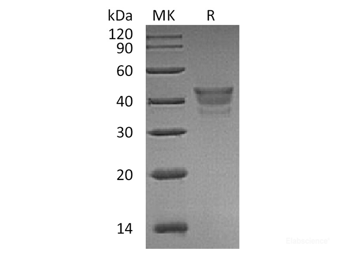 Recombinant Human METAP1 Protein-Elabscience