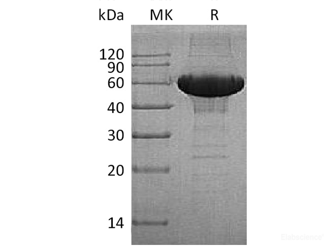 Recombinant Human MMP-3 / Matrix metalloproteinase-3 Protein (C-His)-Elabscience