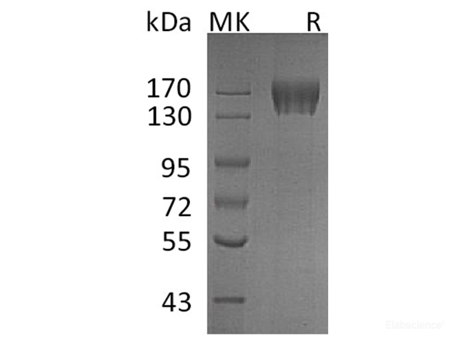 Recombinant Human KIT / c-KIT / CD117 Protein (C-His)-Elabscience