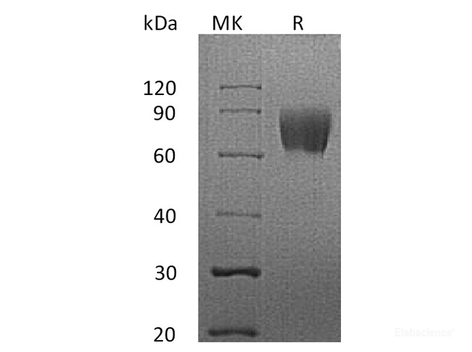 Recombinant Human CD58 / LFA-3 Protein (C-Fc)-Elabscience