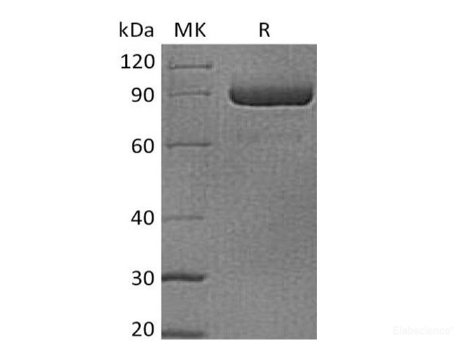 Recombinant Human LAG3 / CD223 Protein (C-mFc)-Elabscience