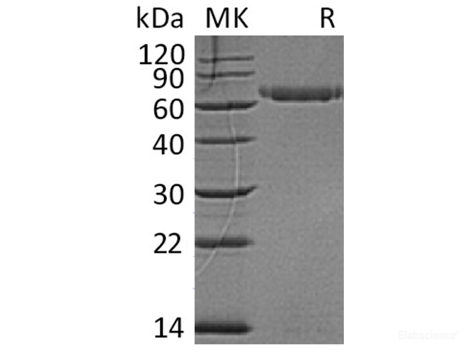 Recombinant Human LAG3 / CD223 Protein (C-His)-Elabscience