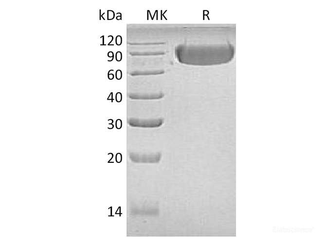 Recombinant Human LAG3 / CD223 Protein (C-Fc)-Elabscience